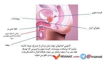 بستن لوله ها در مردان,وازکتومی,جلوگیری از حاملگی در مردان