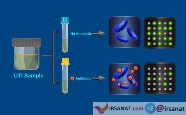 اخبار پزشکی ,خبرهای پزشکی,آنتی بیوتیک