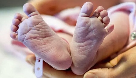 نوزاد متولد شده پیوند رحم از اهداکننده اي كه فوت شده است