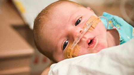 دیسترس تنفسی نوزاد چیست؟
