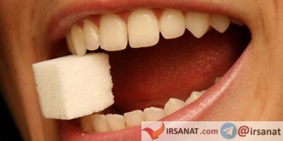 پیشگیری از پوسیدگی دندان, پوسیدگی دندان