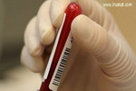 تفسیر نتایج آزمایش تیروئید/راهنمای تفسیر نتایج آزمایش خون(4)